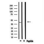 ELAVL2/ELAVL4 Polyclonal Antibody