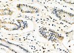 FASTKD2 Polyclonal Antibody
