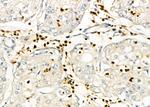 FASTKD2 Antibody in Immunohistochemistry (Paraffin) (IHC (P))