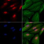 HES6 Polyclonal Antibody