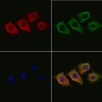 HK3 Antibody in Immunocytochemistry (ICC/IF)