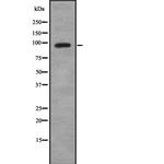 HK3 Antibody in Western Blot (WB)