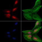 IP6K2 Polyclonal Antibody