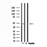 IP6K2 Antibody in Western Blot (WB)