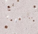 KIF20A Antibody in Immunohistochemistry (Paraffin) (IHC (P))