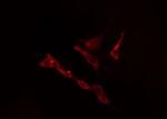 KLHL3 Antibody in Immunocytochemistry (ICC/IF)