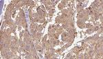 KLHL3 Antibody in Immunohistochemistry (Paraffin) (IHC (P))