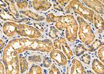 NOX1 Polyclonal Antibody
