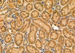 NOX1 Antibody in Immunohistochemistry (Paraffin) (IHC (P))
