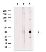 OR1D4/OR1D5 Antibody in Western Blot (WB)