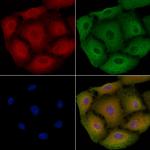 OR2A25 Polyclonal Antibody