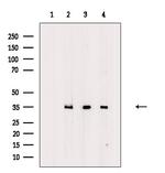 OR2A5/OR2A14 Polyclonal Antibody