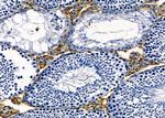 OR4K2 Antibody in Immunohistochemistry (Paraffin) (IHC (P))