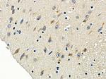 OR5H6 Polyclonal Antibody
