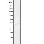 OR5H6 Antibody in Western Blot (WB)