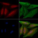 OR5M3 Polyclonal Antibody