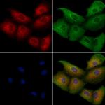 OR5V1 Polyclonal Antibody