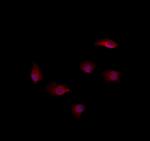 RAB35 Polyclonal Antibody