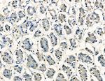 RHPN1 Antibody in Immunohistochemistry (Paraffin) (IHC (P))