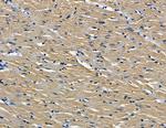 RHPN1 Antibody in Immunohistochemistry (Paraffin) (IHC (P))