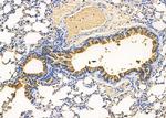RIOK3 Antibody in Immunohistochemistry (Paraffin) (IHC (P))