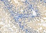 RIOK3 Antibody in Immunohistochemistry (Paraffin) (IHC (P))