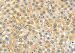 RMP Antibody in Immunohistochemistry (Paraffin) (IHC (P))
