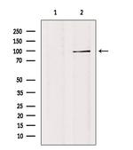 GTF3C3 Polyclonal Antibody