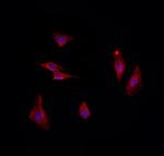 UBTD2 Polyclonal Antibody