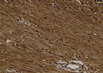 Phospho-CK1 alpha (Tyr294) Polyclonal Antibody
