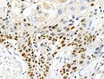 SUMO2/SUMO3/SUMO4 Polyclonal Antibody