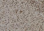 TGIF2LY Polyclonal Antibody