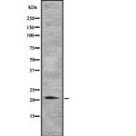 TGIF2LY Antibody in Western Blot (WB)