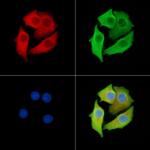 MAGEC1 Polyclonal Antibody