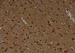 MAGEC1 Antibody in Immunohistochemistry (Paraffin) (IHC (P))
