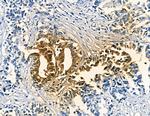 MAGEC1 Antibody in Immunohistochemistry (Paraffin) (IHC (P))