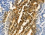 MAGEC1 Antibody in Immunohistochemistry (Paraffin) (IHC (P))
