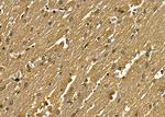 SNAPC5 Polyclonal Antibody