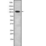 CDKL5 Antibody in Western Blot (WB)