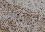 FSBP Polyclonal Antibody