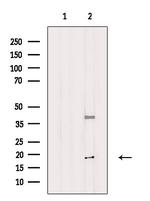 FSBP Antibody in Western Blot (WB)