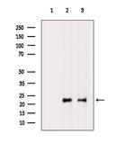 DUSP14 Antibody in Western Blot (WB)