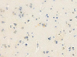 ANP32D Antibody in Immunohistochemistry (IHC)