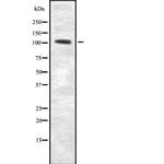 RECK Polyclonal Antibody