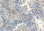 Herpes Simplex Virus Type 1 (strain 17) Polyclonal Antibody