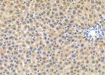 Herpes Simplex Virus Type 1 (strain 17) Polyclonal Antibody