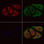 Varicella zoster Virus (strain Dumas) Antibody in Immunocytochemistry (ICC/IF)