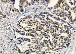 ZNF7 Antibody in Immunohistochemistry (Paraffin) (IHC (P))
