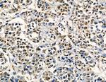 ZNF7 Antibody in Immunohistochemistry (Paraffin) (IHC (P))