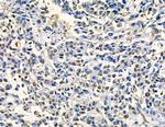 ZNF7 Antibody in Immunohistochemistry (Paraffin) (IHC (P))